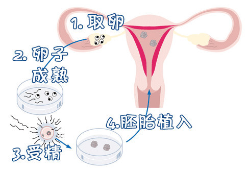 代生选性别包男孩